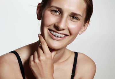 Керамічні Брекети Ціна | Франківськ | Ali’s Premium Dental Care