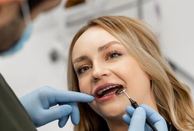 Брекети Металеві Ціна | Франківськ | Ali’s Premium Dental Care