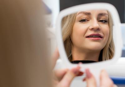 Брекети на Верхню Щелепу | Франківськ | Ali’s Premium Dental