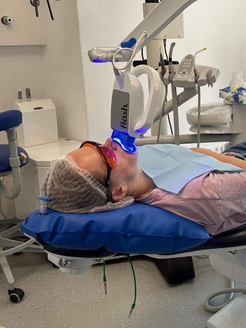 Відбілювання Зубів в Івано-Франківську | Ali’s Premium