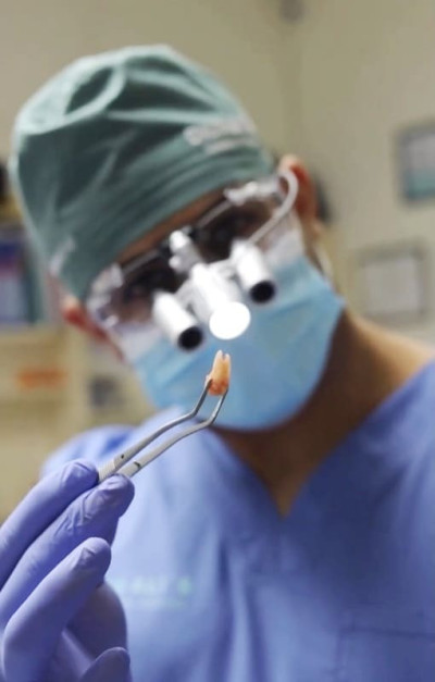 Видалення зуба Ali’s Premium Dental Care, Видалення зуба стоматологічна клініка, стоматологічна клініка Івано-Франківськ