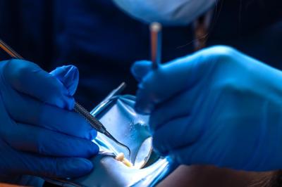 Видалення Зубного Нерва | Франківськ | Ali’s Premium Dental