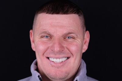 Імплантація Зубів All-on-6 Ціна | Ali’s Premium Dental Care