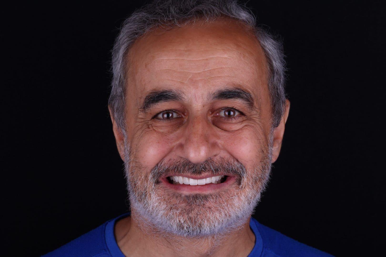 після Ali’s Premium Dental Care 220