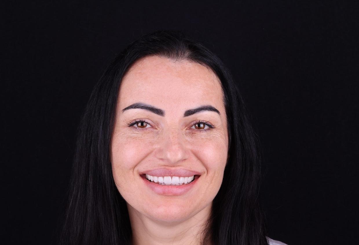 після Ali’s Premium Dental Care 231