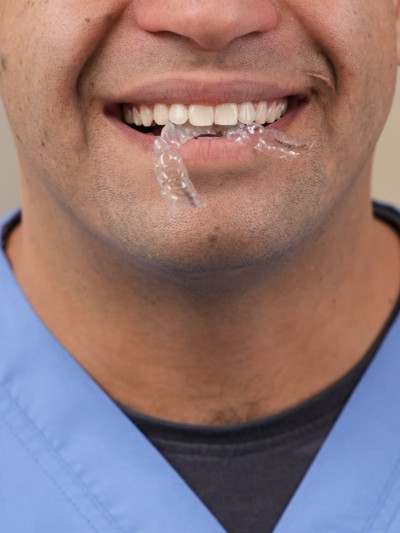 Вирівнювання зубів Ali’s Premium Dental Care, Вирівнювання зубів стоматологічна клініка, стоматологічна клініка Івано-Франківськ