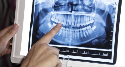 КТ Зубів - Івано-Франківськ | Ali’s Premium Dental Care