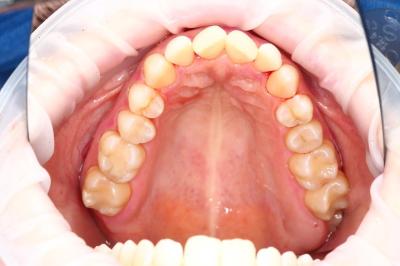 Професійна Гігієна Ротової Порожнини | Ali’s Premium Dental Care