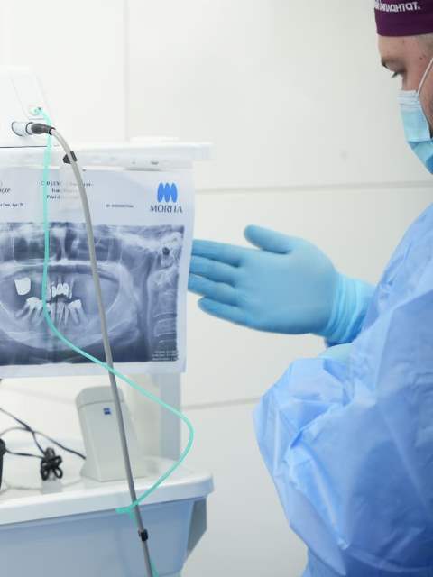 Surgical dentistry. Removal of teeth Ali’s Premium Dental Care, Surgical dentistry. Removal of teeth dental clinic, dental clinic Ivano-Frankivsk