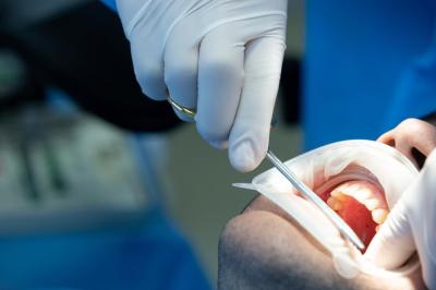 Видалення Корінного Зуба у Франківську | Ali’s Premium Dental