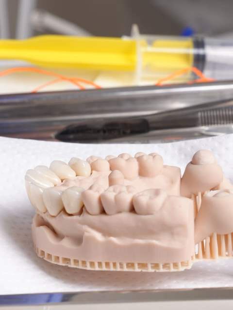 Протезування зубів Ali’s Premium Dental Care, Протезування зубів стоматологічна клініка, стоматологічна клініка Івано-Франківськ