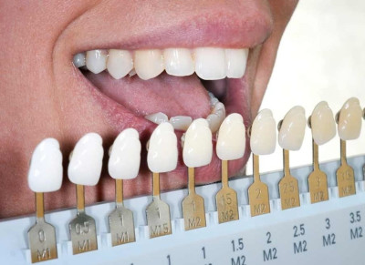 Протезування зубів Ali’s Premium Dental Care, Протезування зубів стоматологічна клініка, стоматологічна клініка Івано-Франківськ