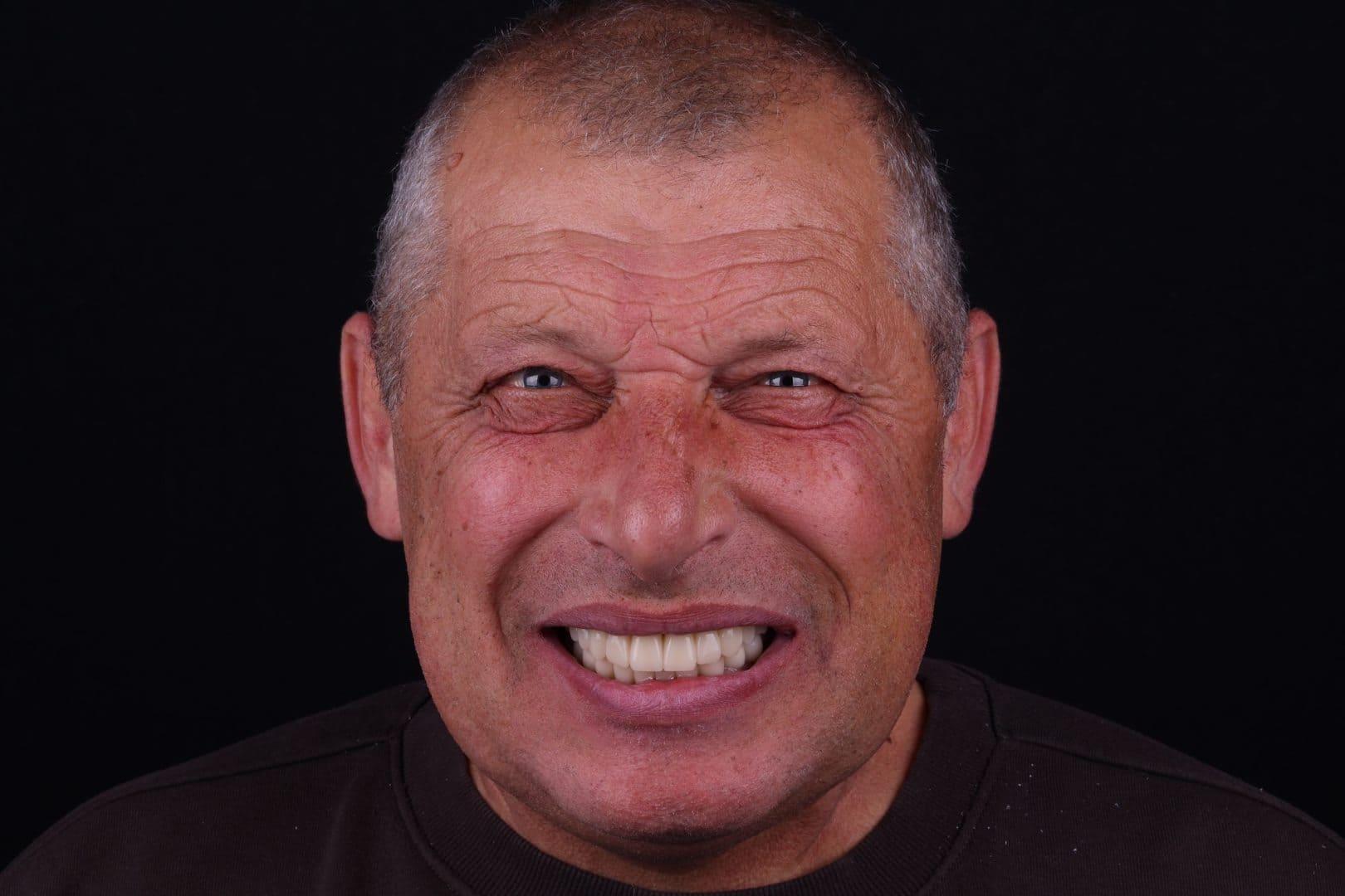 after Ali’s Premium Dental Care 219