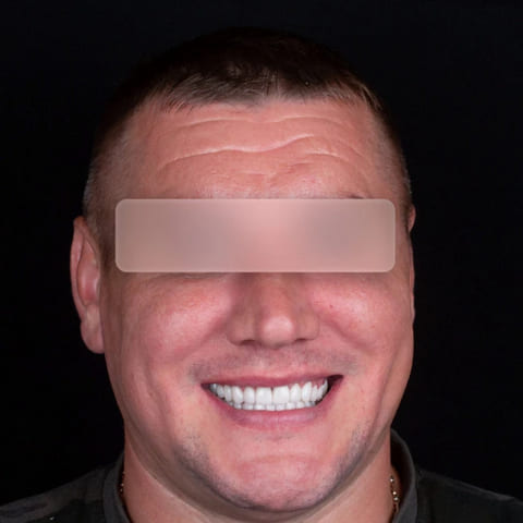 after Ali’s Premium Dental Care 225