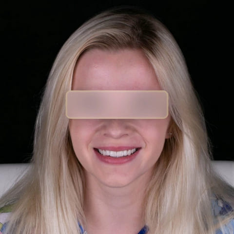 after Ali’s Premium Dental Care 203