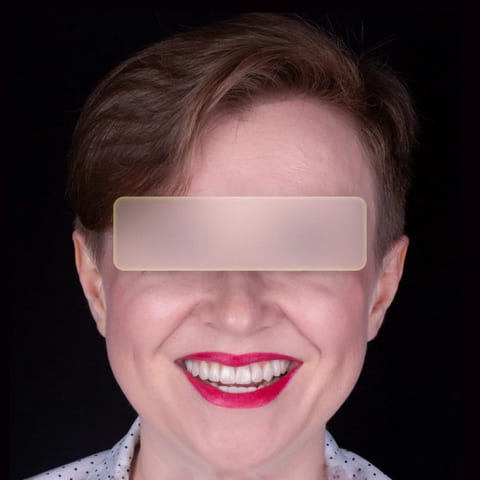 after Ali’s Premium Dental Care 204
