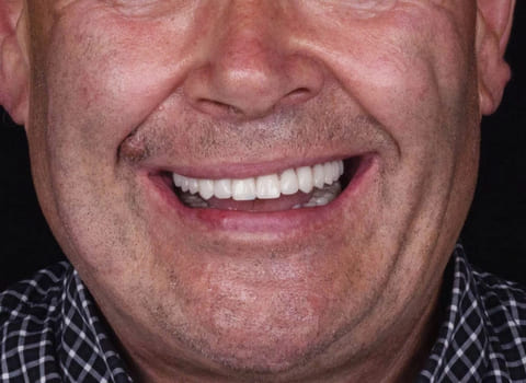 after Ali’s Premium Dental Care 206