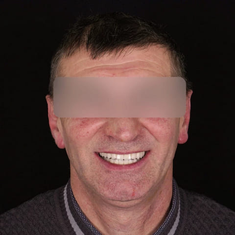 after Ali’s Premium Dental Care 207