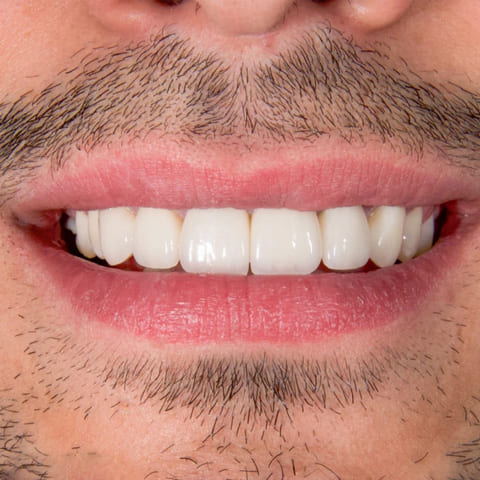 after Ali’s Premium Dental Care 208