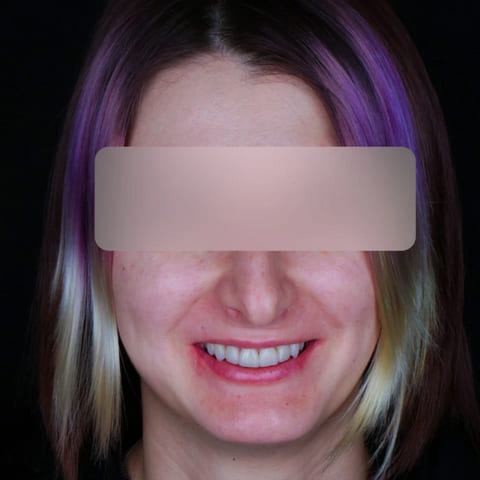 after Ali’s Premium Dental Care 209