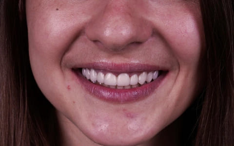 after Ali’s Premium Dental Care 212