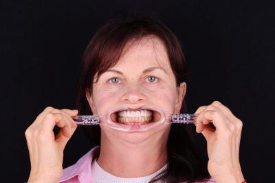 after Ali’s Premium Dental Care 217