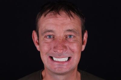 after Ali’s Premium Dental Care 218