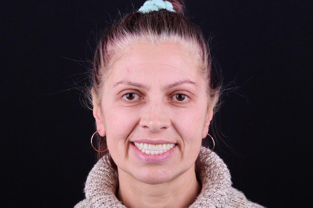после Ali’s Premium Dental Care 229
