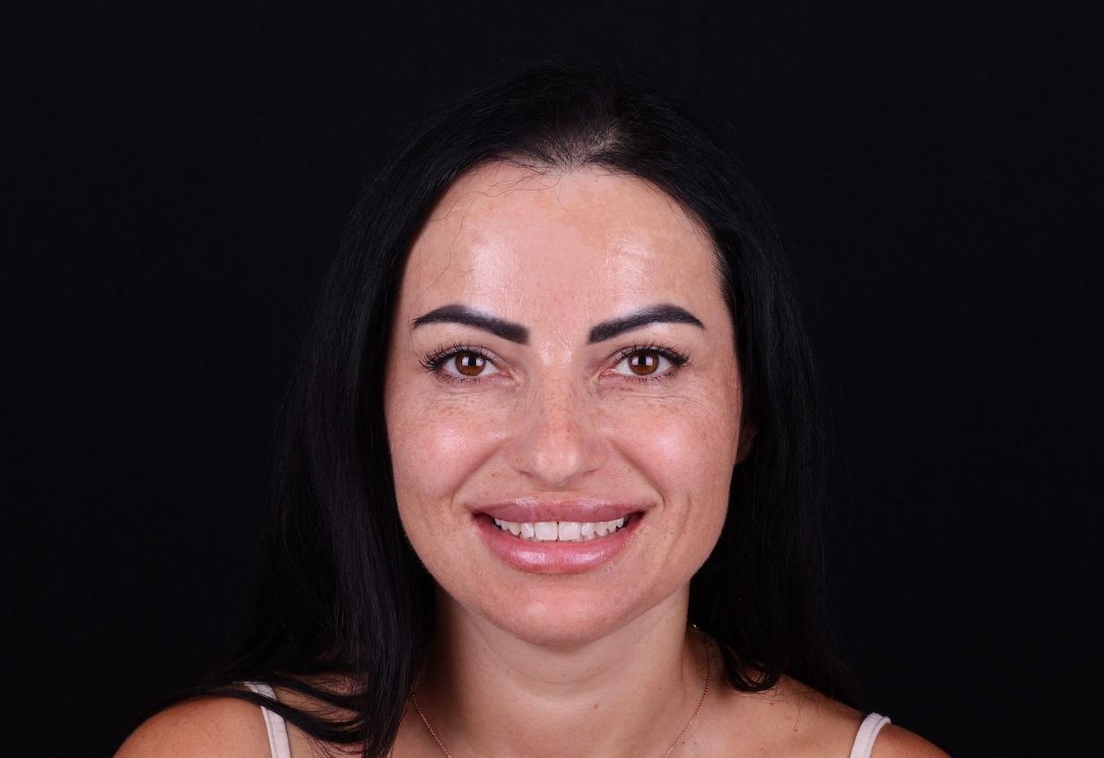 before Ali’s Premium Dental Care 231