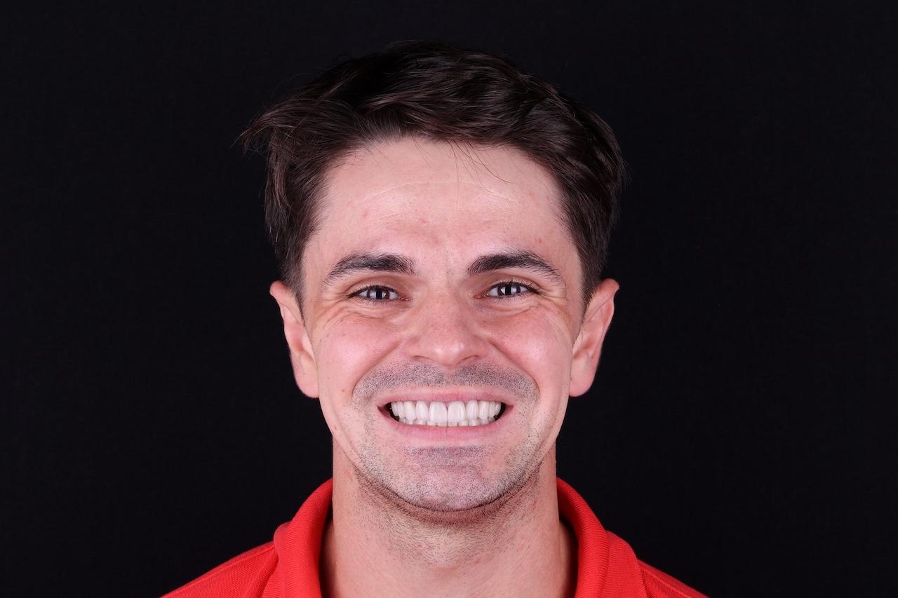 after Ali’s Premium Dental Care 232