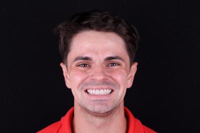 after Ali’s Premium Dental Care 232