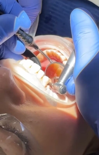 Medicated sleep.
Treatment of teeth in a sleep Ali’s Premium Dental Care, Medicated sleep.
Treatment of teeth in a sleep dental clinic, dental clinic Ivano-Frankivsk