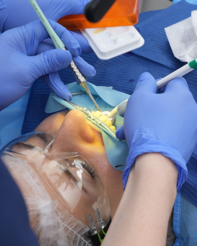 Medicated sleep.
Treatment of teeth in a sleep Ali’s Premium Dental Care, Medicated sleep.
Treatment of teeth in a sleep dental clinic, dental clinic Ivano-Frankivsk