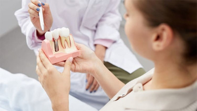 Имплантация зубов. Зубные импланты Ali’s Premium Dental Care, Имплантация зубов. Зубные импланты стоматологическая клиника, стоматологическая клиника Ивано-Франковск