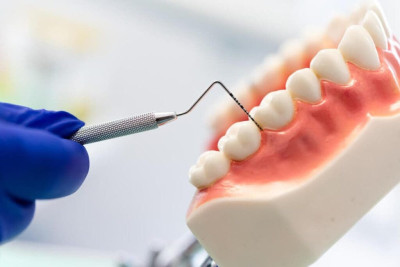 Periodontology. Gum treatment Ali’s Premium Dental Care, Periodontology. Gum treatment dental clinic, dental clinic Ivano-Frankivsk