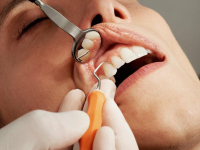 Periodontology. Gum treatment Ali’s Premium Dental Care, Periodontology. Gum treatment dental clinic, dental clinic Ivano-Frankivsk